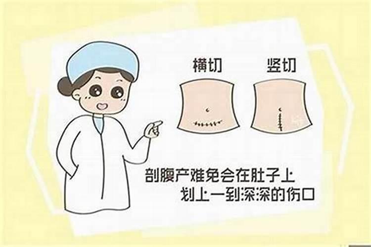 剖腹产生辰八字按哪个算起