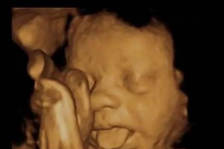 梦见自己怀孕了胎儿还在肚子里动是什么意思
