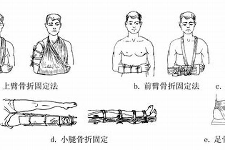 骨折伤员的转运方法