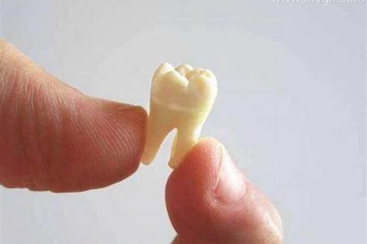男人梦见掉大牙齿是什么征兆